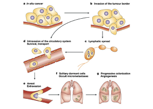 metastasis process