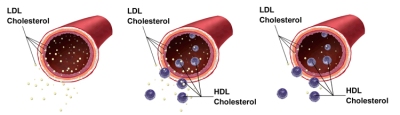 HDL and LDL cholesterol. Best Health Nutritionals.